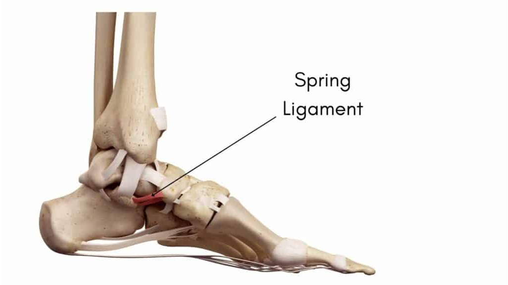 Ligament Tear